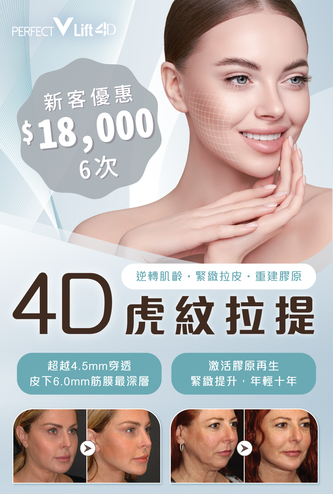 4D 虎紋拉提