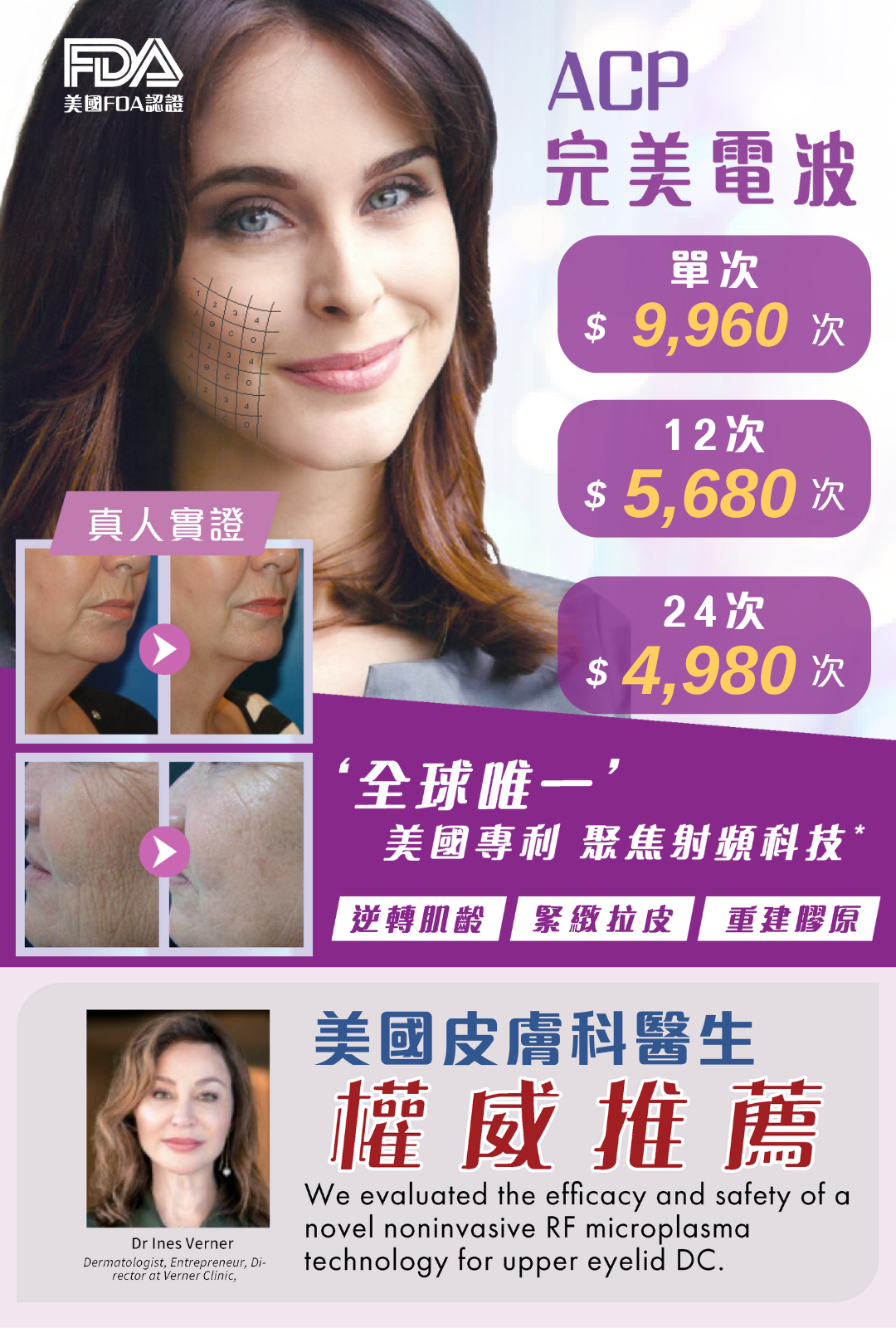 ACP完美電波