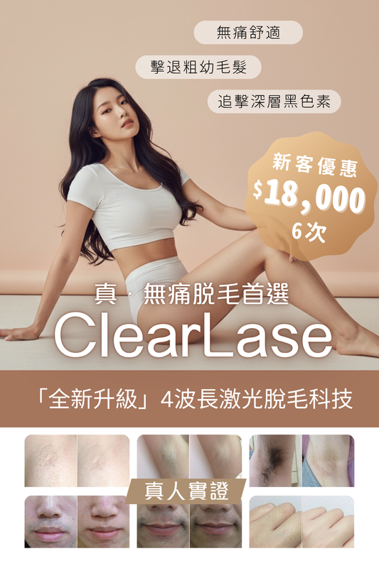 ClearLase