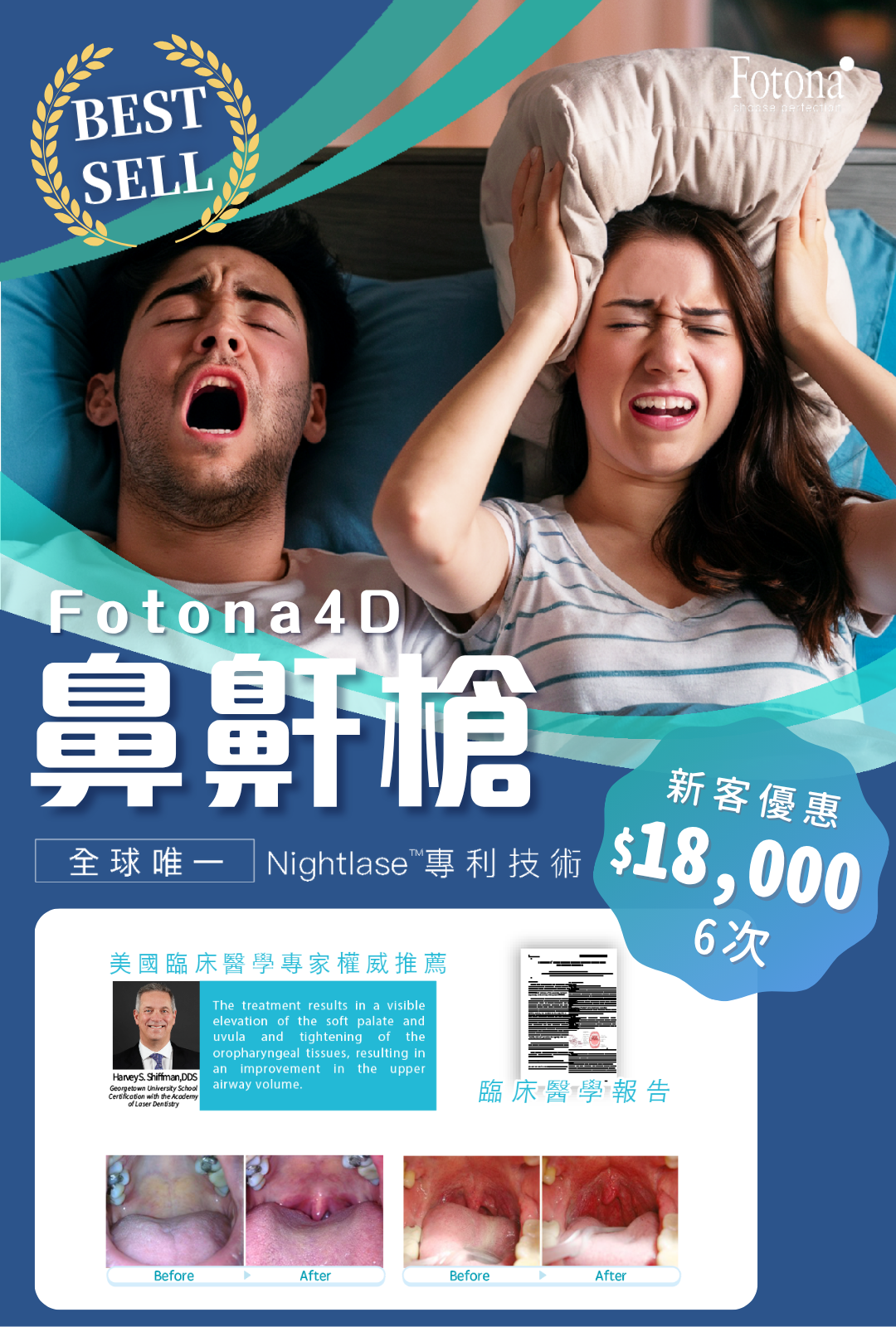 Fotona4D鼻鼾槍