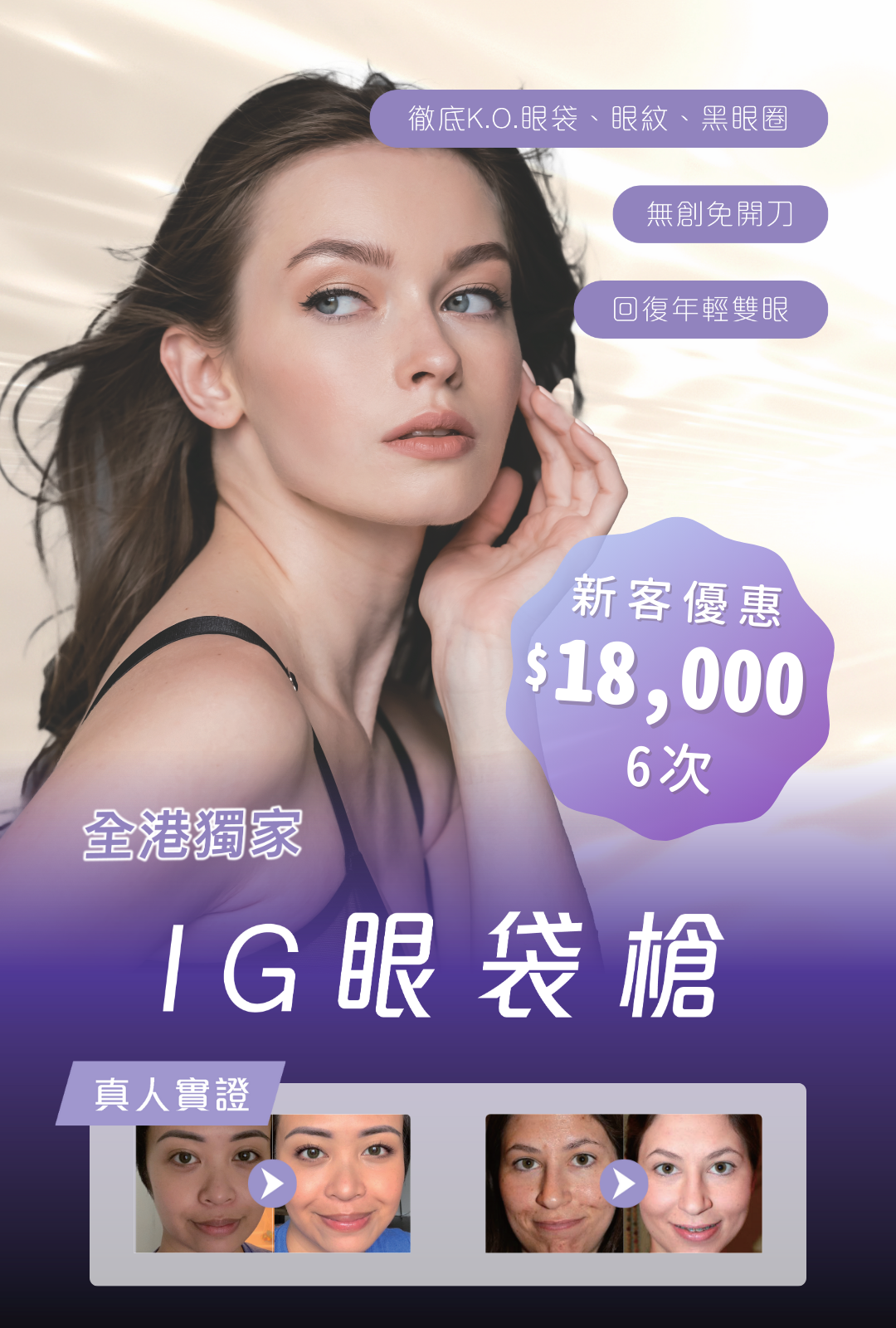 IG 眼袋槍