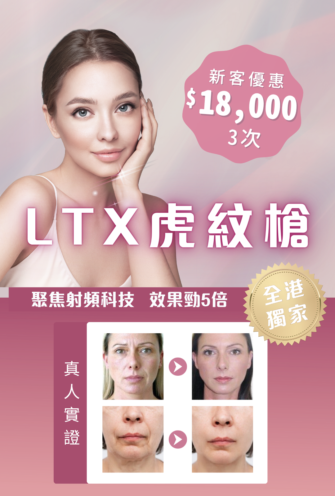 LTX虎紋槍