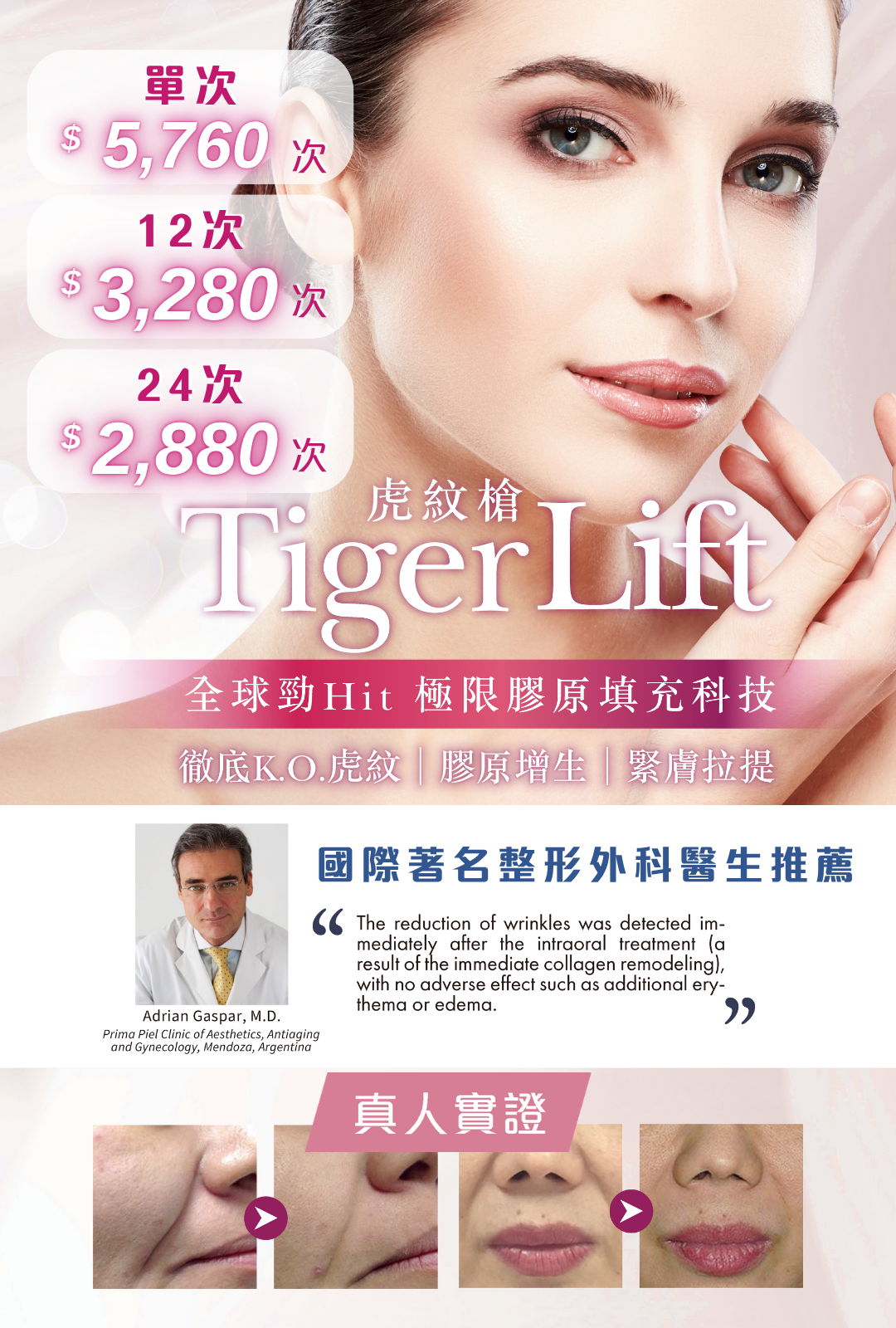 Tiger Lift虎紋槍
