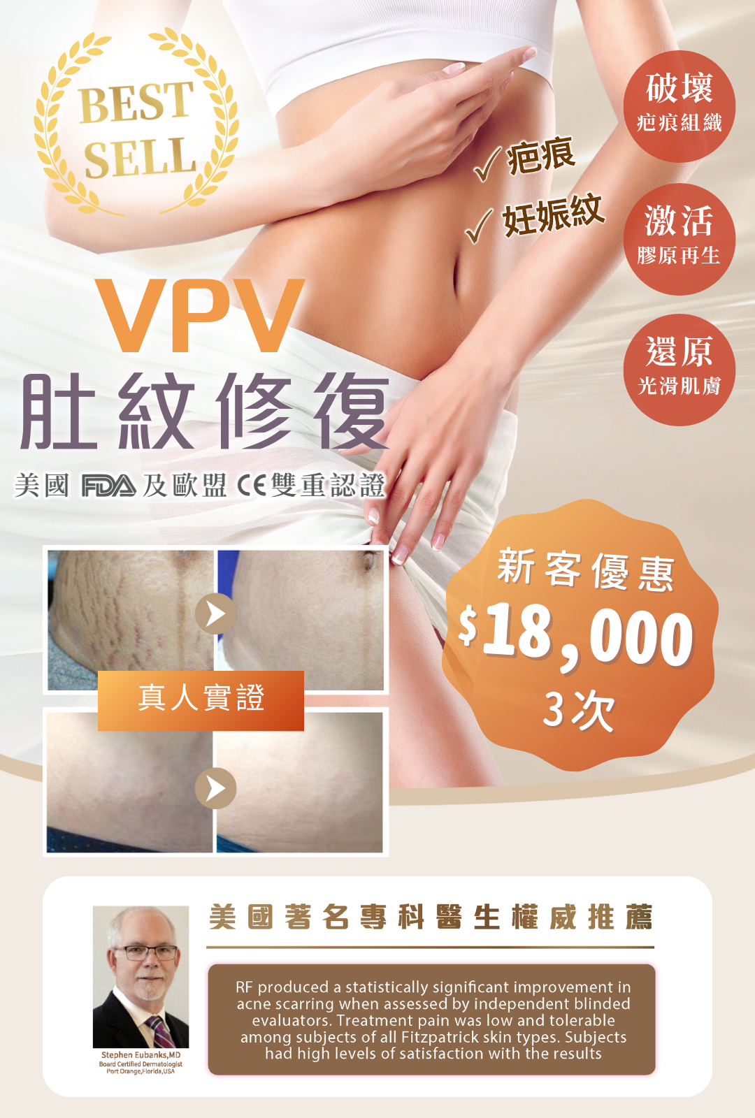 VPV肚紋修復